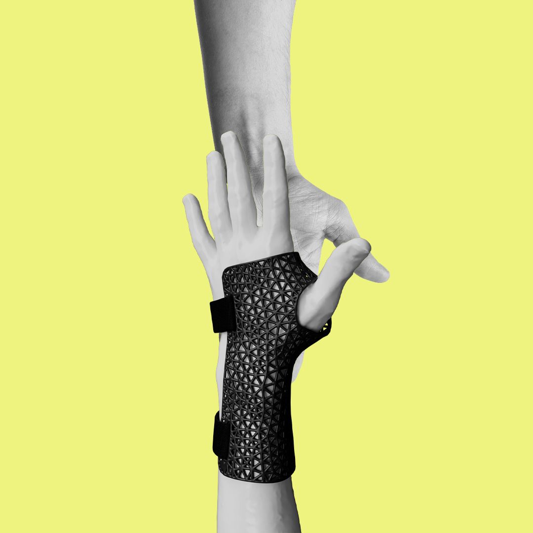 2 hands touching. One wearing a 3D printed orthosis.