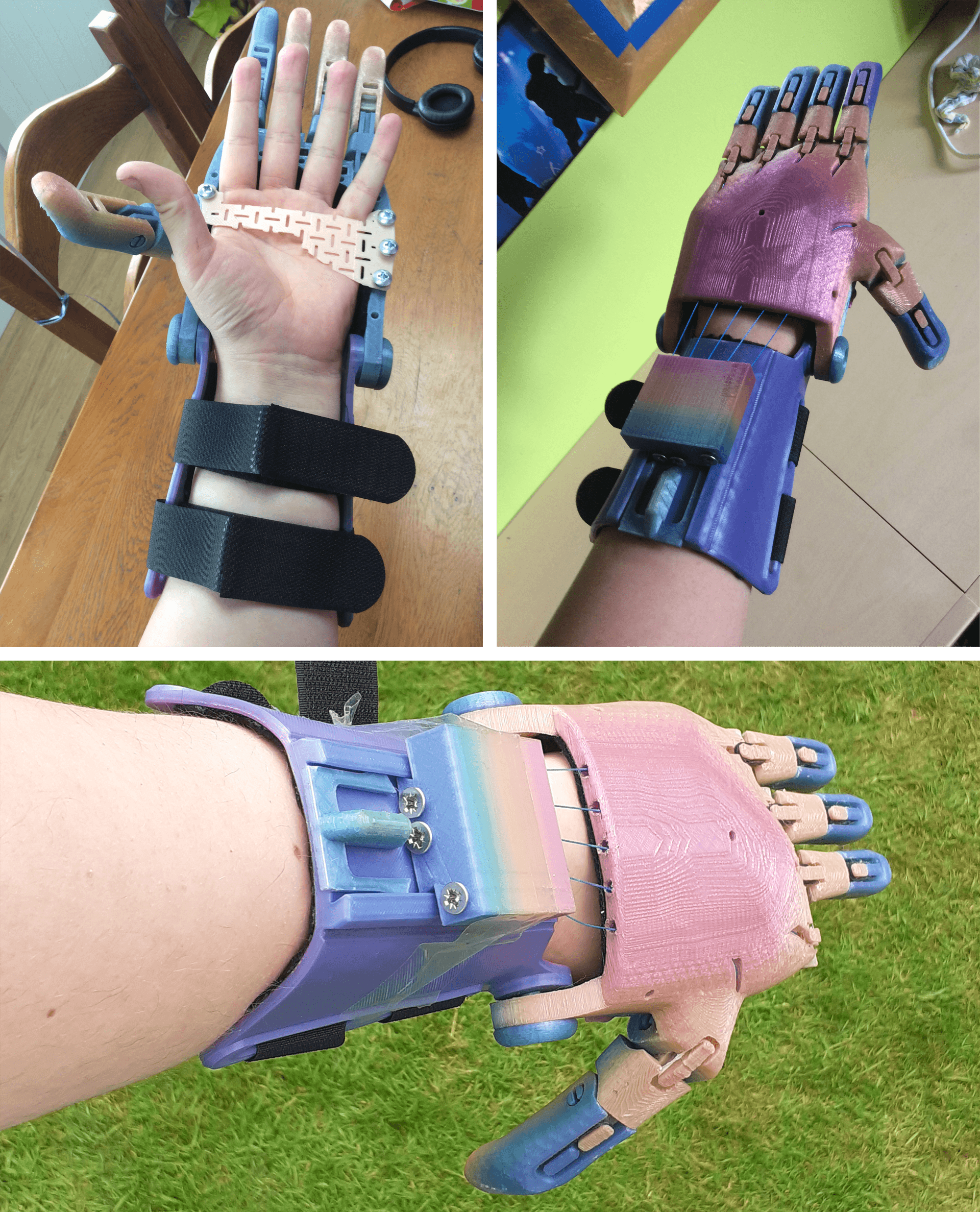 Designing Prosthetic Upper Limb Devices for the Make:able Challenge