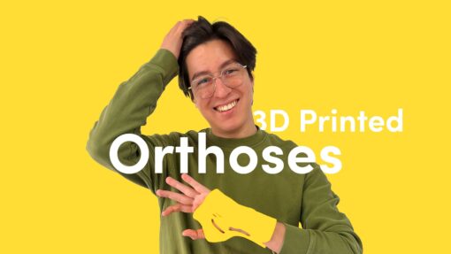 Maker Educator Jose Antonio wearing a 3D printed wrist orthosis.