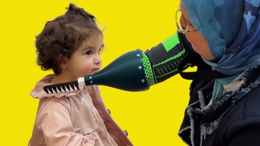 Karima uses a 3D printed assistive arm device to brush her daughter Jouri’s hair. The image captures the device in use, showing how it supports everyday family routines.